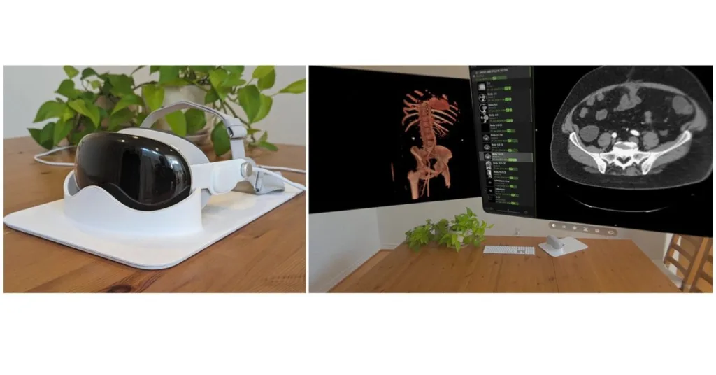 new-apple-vision-pro-study-reveals-promising-performance-in-radiology